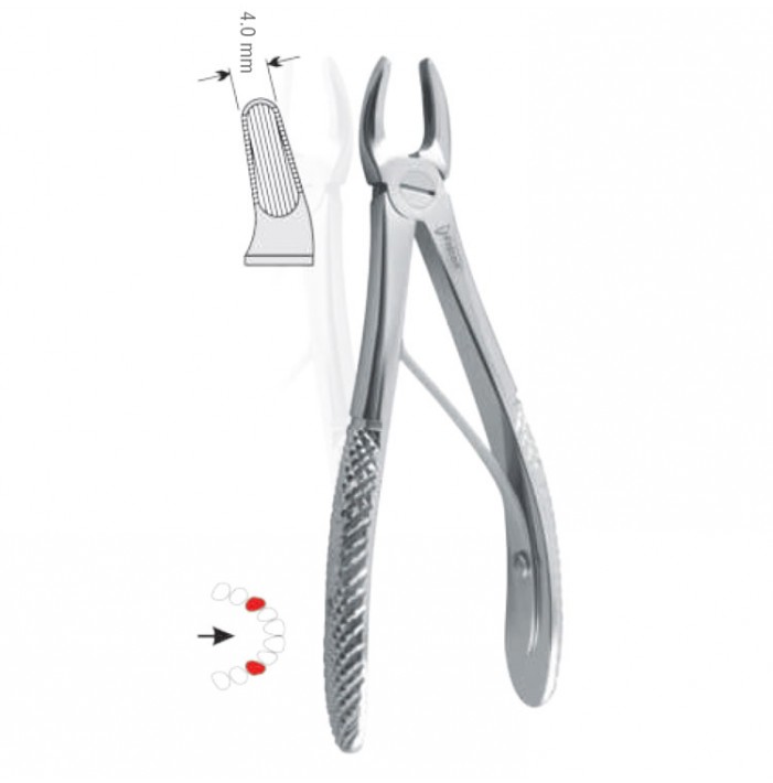 Extracting forceps children pattern fig. 139
