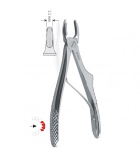 Extracting forceps children pattern fig. 137