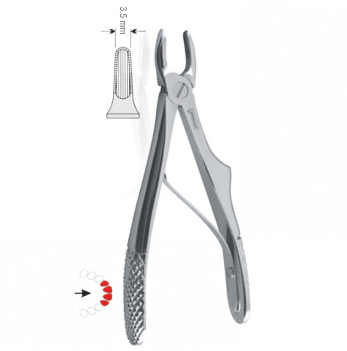 Extracting forceps children pattern fig. 137