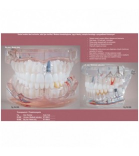 Real Series Model stomatologiczny zgryz idealny z przypadkami klinicznymi przeźroczysty wielkość naturalna