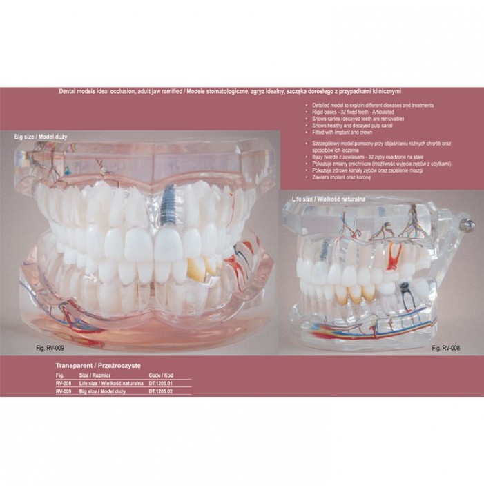 Real Series Model stomatologiczny zgryz idealny z przypadkami klinicznymi, przeźroczysty, wielkość naturalna