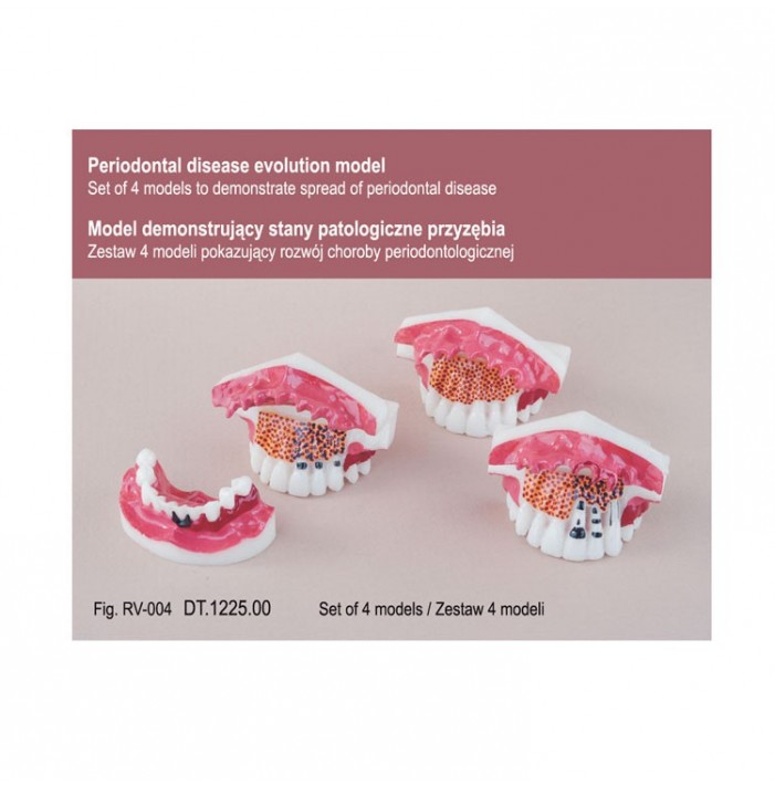 Real Series Zestaw modeli demonstrujący choroby periodontologiczne