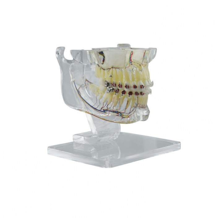 Real Series Model ortodontyczny z metalowymi i ceramicznymi  zamkami (na biurko)