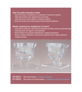 Real Series Model ortodontyczny z metalowymi i ceramicznymi  zamkami (na biurko)