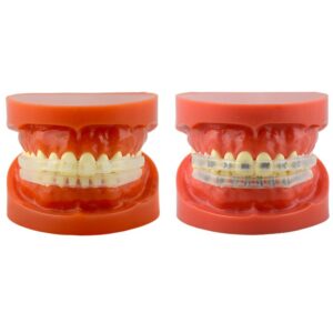 Ochraniacze wargowe silikonowe para