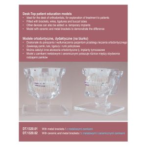 Real Series Model ortodontyczny z metalowymi i ceramicznymi zamkami (na biurko)