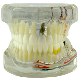 Real Series Dental model ideal occlusion transparent ramified, life size