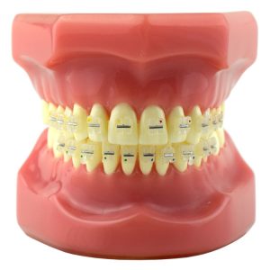 Model pokazowy z zamkami Ceramika-III Roth .022"