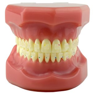 Model pokazowy z zamkami Ceramika-II Roth .022"